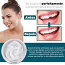 Sorriso novo em minutos! Facetas Dentárias (Natural e confortável!)