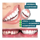 Sorriso novo em minutos! Facetas Dentárias (Natural e confortável!)